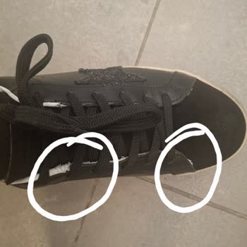 Kusurlu Ayakkabı Ve Yetersiz Müşteri Hizmeti Nedeniyle Mağduriyet