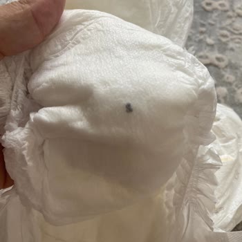 Bebek Bezinde Siyah Yabancı Maddeyle Karşılaştık Hijyen Endişesi Yaşıyoruz