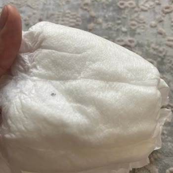 Bebek Bezinde Siyah Yabancı Maddeyle Karşılaştık Hijyen Endişesi Yaşıyoruz