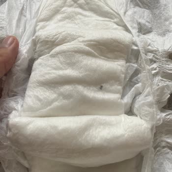 Bebek Bezinde Siyah Yabancı Maddeyle Karşılaştık Hijyen Endişesi Yaşıyoruz