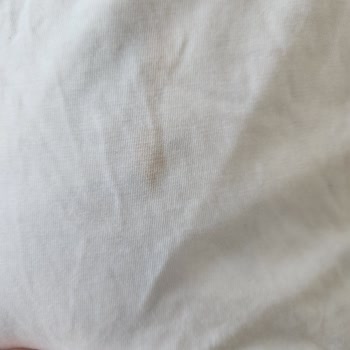 Alo Çamaşır Tozunun Leke Çıkarmaması Ve Müşteri Hizmetlerine Ulaşılamaması