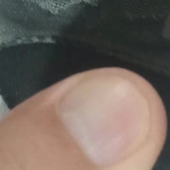 Kısa Sürede Parçalanan Ayakkabı İçin Değişim Talebim Reddedildi