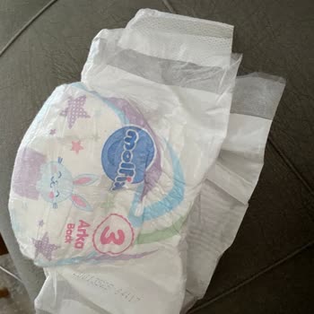 Molfix 3 Numara Bebek Bezinde Siyah Yabancı Madde Şoku