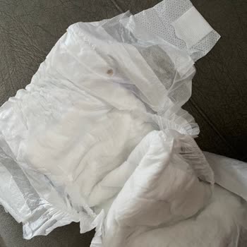 Molfix 3 Numara Bebek Bezinde Siyah Yabancı Madde Şoku