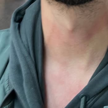 Otobüs Şoförünün Fiziksel Saldırısı Ve Firma İlgisizliği Nedeniyle Mağduriyet