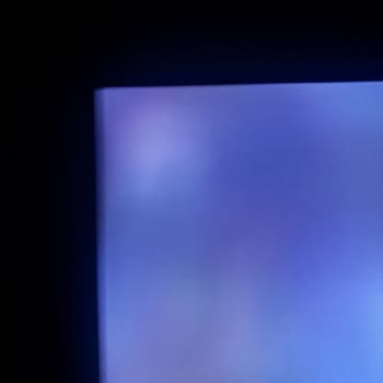 Yeni Aldığım LG Televizyonda Köşe Parlama Sorunu Ve İlgisiz Müşteri Hizmetleri