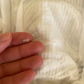 Molfix Bebek Bezinde Kurt Ve Böcek Çıkması Nedeniyle Hijyen Sorunu