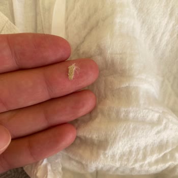 Molfix Bebek Bezinde Kurt Ve Böcek Çıkması Nedeniyle Hijyen Sorunu