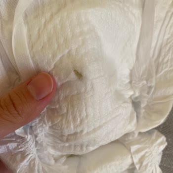 Molfix Bebek Bezinde Kurt Ve Böcek Çıkması Nedeniyle Hijyen Sorunu