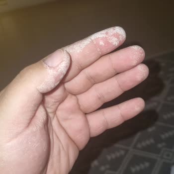 Vanish Kosla Leke Çıkarıcı Ellerde Tahrişe Sebep Oldu, Markadan Geri Dönüş Alamadım