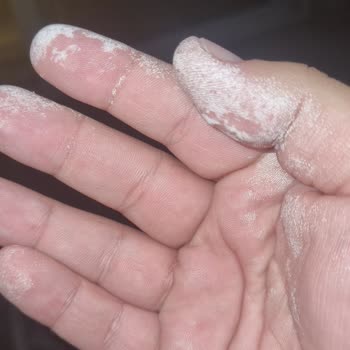 Vanish Kosla Leke Çıkarıcı Ellerde Tahrişe Sebep Oldu, Markadan Geri Dönüş Alamadım