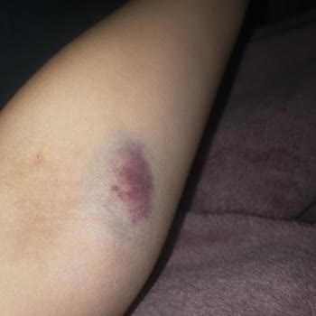 Acil Serviste Hemşirenin Hatalı Uygulaması Ve Saygısız Davranışı Sonucu Mağduriyet