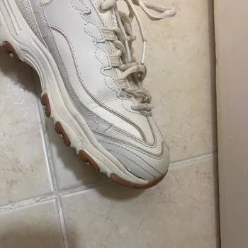 Skechers Ayakkabı Tabanı 4 Ayda Açıldı, Garanti Kapsamı Reddedildi