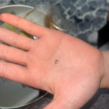 Galeta Paketinde Kıl Çıkması Nedeniyle Yaşanan Hijyen Sorunu