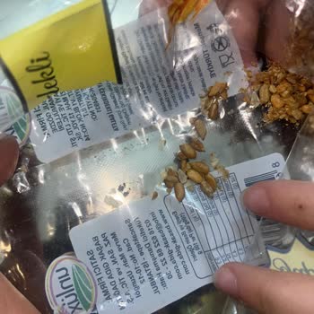 Galeta Paketinde Kıl Çıkması Nedeniyle Yaşanan Hijyen Sorunu