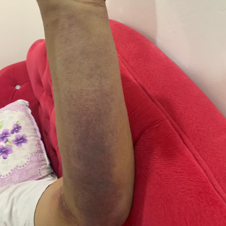 Adana Şehir Hastanesi KVC Yoğun Bakımında İhmalkârlık Ve İlgisizlik