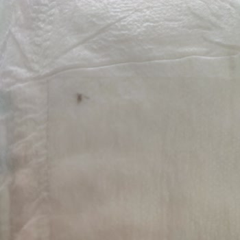 Bebek Bezinde Kirli Katman Sorunu Ve Hijyen Endişesi