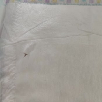 Bebek Bezinde Kirli Katman Sorunu Ve Hijyen Endişesi