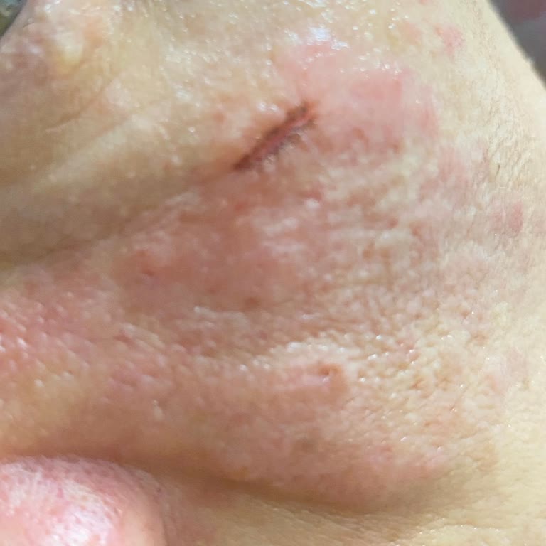 Ayşe Avcı Premium | Güzellik Salonu Cilt Bakım İşlemi Sonrasında Yüzümde Ciddi Tahriş Oluştu!