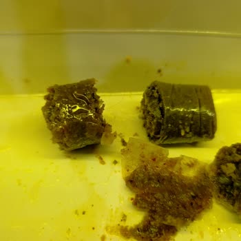 Baklavadan Kıl Çıktı, Hijyen Ve İletişim Sorunu Yaşadım