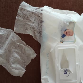 Sleepy Islak Mendil Paketinde Eksik Ve Parçalanmış Ürün Sorunu