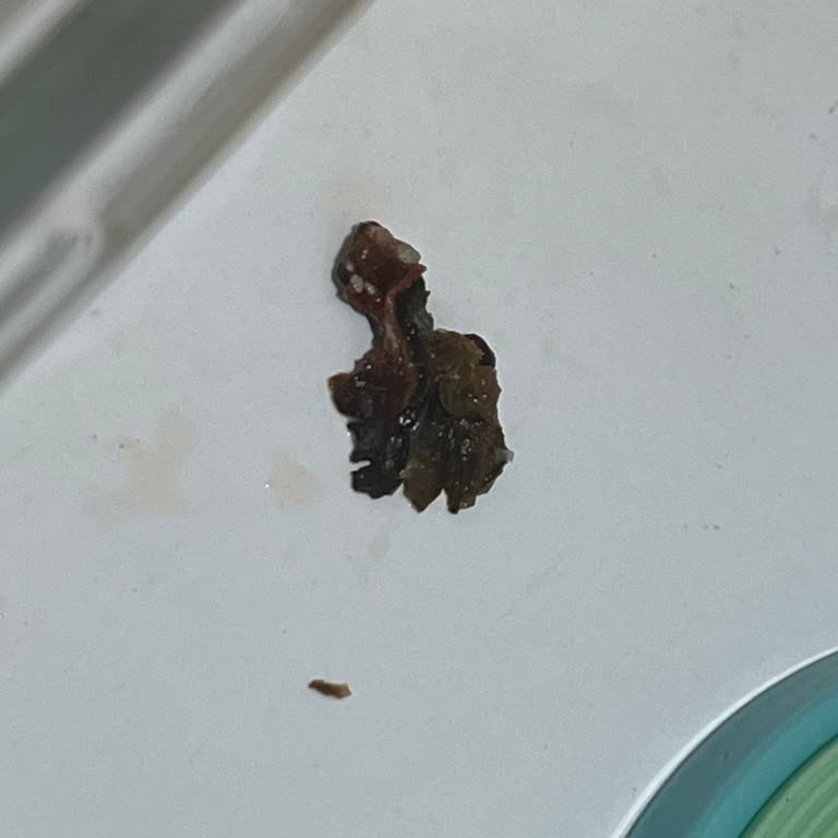 Dondurulmuş Sebzede Siyah Yabancı Cisimle Karşılaştım, Açıklama Bekliyorum