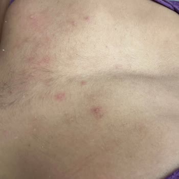 MR. Falcon Lazer Hem Maddi Hem Manevi Olarak Mağdur Edildim!