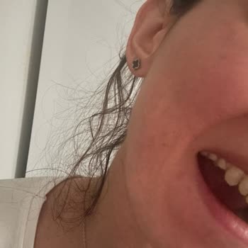 Dişlerim İstemeden Kesildi Ve Kliniğin Hatasını Kabul Etmemesi Beni Mağdur Etti