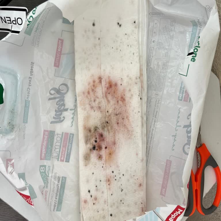 Sleepy Mop Uçlarının Küflenmesi Hayal Kırıklığı Yarattı