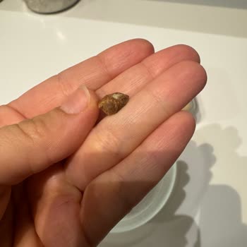 Aldığım Helvanın İçinden Taş Çıktı, Sağlığım Tehlikeye Girdi