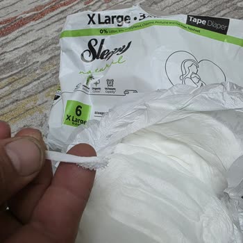 Bebek Bezinde Sivri Plastik Cisim Ve Müşteri Hizmetlerinden Yanıt Alamadık