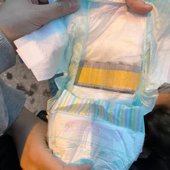 Bebek Bezinde Yabancı Madde: BİM Ve Jenny Willy'den Mağduriyetimin Giderilmesini Talep Ediyorum