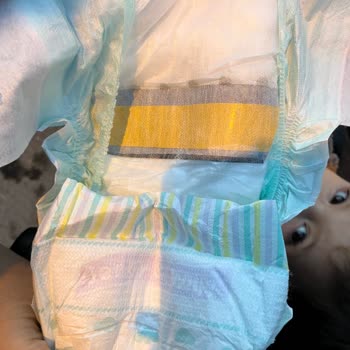 Bebek Bezinde Yabancı Madde: BİM Ve Jenny Willy'den Mağduriyetimin Giderilmesini Talep Ediyorum