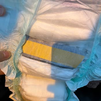 Bebek Bezinde Yabancı Madde: BİM Ve Jenny Willy'den Mağduriyetimin Giderilmesini Talep Ediyorum