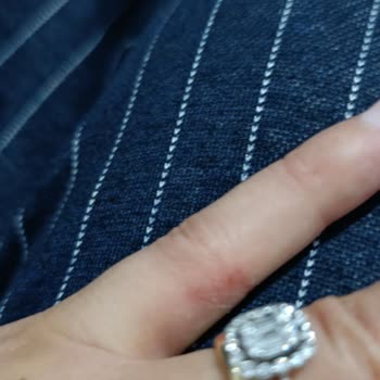 Lizay Pırlanta Sürekli Taşı Düşen Yüzük Ve Çözülmeyen Sorunlar!