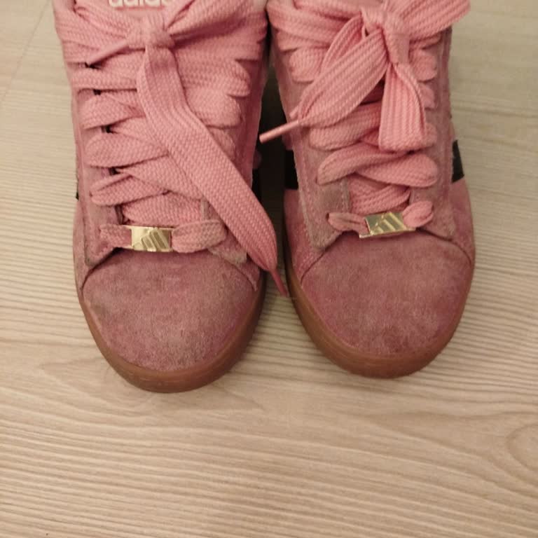 Aldığım Spor Ayakkabıda Kısa Sürede Aşırı Renk Deformasyonu Yaşadım