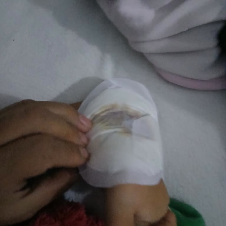 Aldığım Ayakkabının İçinden Çıkan Alarm İğnesi Çocuğumun Ayağına Battı