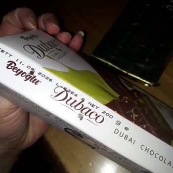 Çikolatadan Saç Çıkması Hijyen Ve Güven Sorunu Yarattı