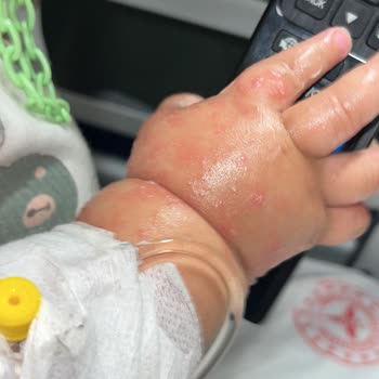 Çocuğumun Hastanede Kaldığı Sürede İlgisizlik Ve Yanlış Teşhis Mağduriyeti