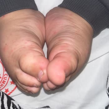 Çocuğumun Hastanede Kaldığı Sürede İlgisizlik Ve Yanlış Teşhis Mağduriyeti