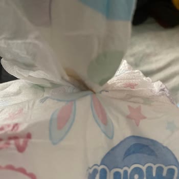 Molfix Bebek Bezinde Jel Sızıntısı Ve Yapışkan Madde Sorunu Yaşadım