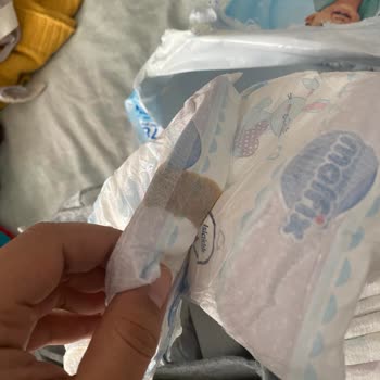 Molfix Bebek Bezinde Jel Sızıntısı Ve Yapışkan Madde Sorunu Yaşadım