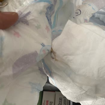 Molfix Bebek Bezinde Jel Sızıntısı Ve Yapışkan Madde Sorunu Yaşadım