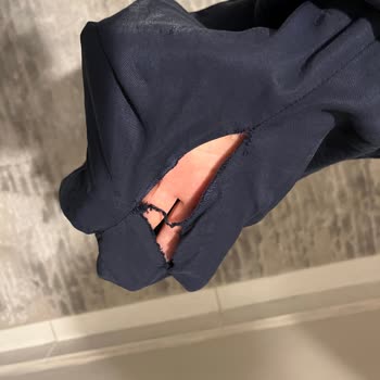 Satın Aldığım Pantolon Bir Gün İçinde Yırtıldı, İade Talebim Reddedildi