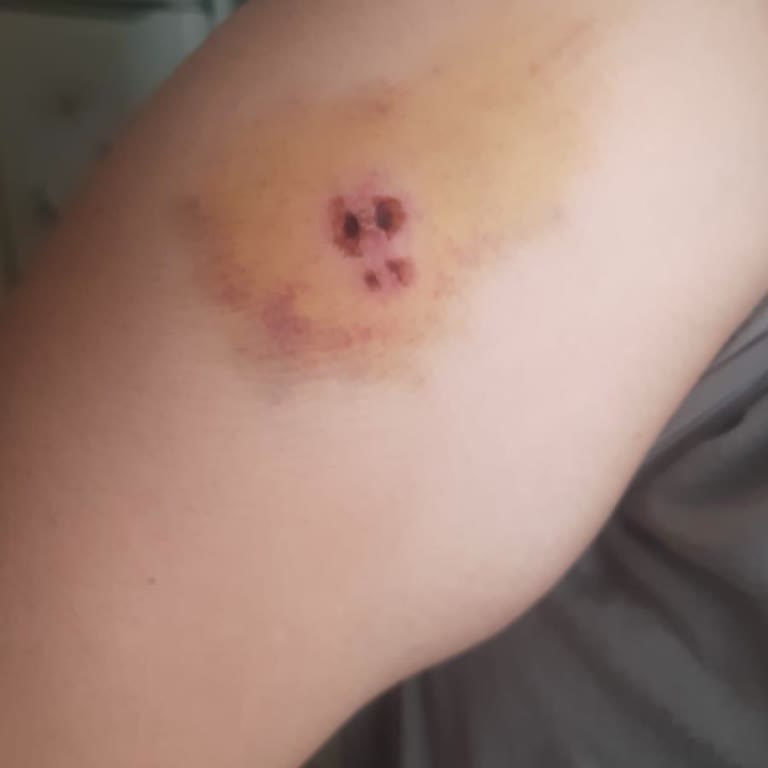 Aslanbey Çiftliği'nde Güvenlik Ve İlgi Eksikliği Mağduriyeti