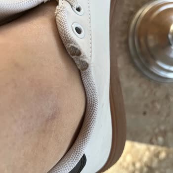 Aldığım Ayakkabı İki Ay Dolmadan Bozuldu İade Talebim Reddedildi