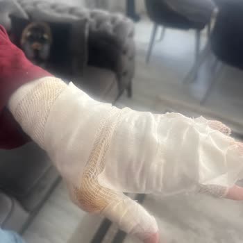 İlk Kullanımda Ciddi Arıza Ve Yaralanma