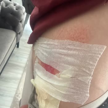 İlk Kullanımda Ciddi Arıza Ve Yaralanma