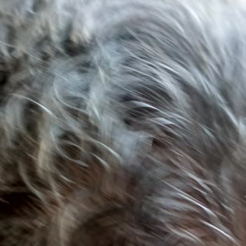 Elidor Şampuan Sonrası Saç Diplerimde İltihap Ve Kalıcı Zarar Yaşadım