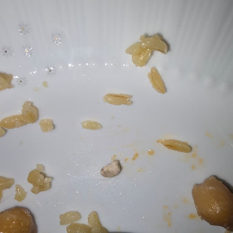 Bulgur Pilavında Taş Sürprizi: Dişim Kırılıyordu!